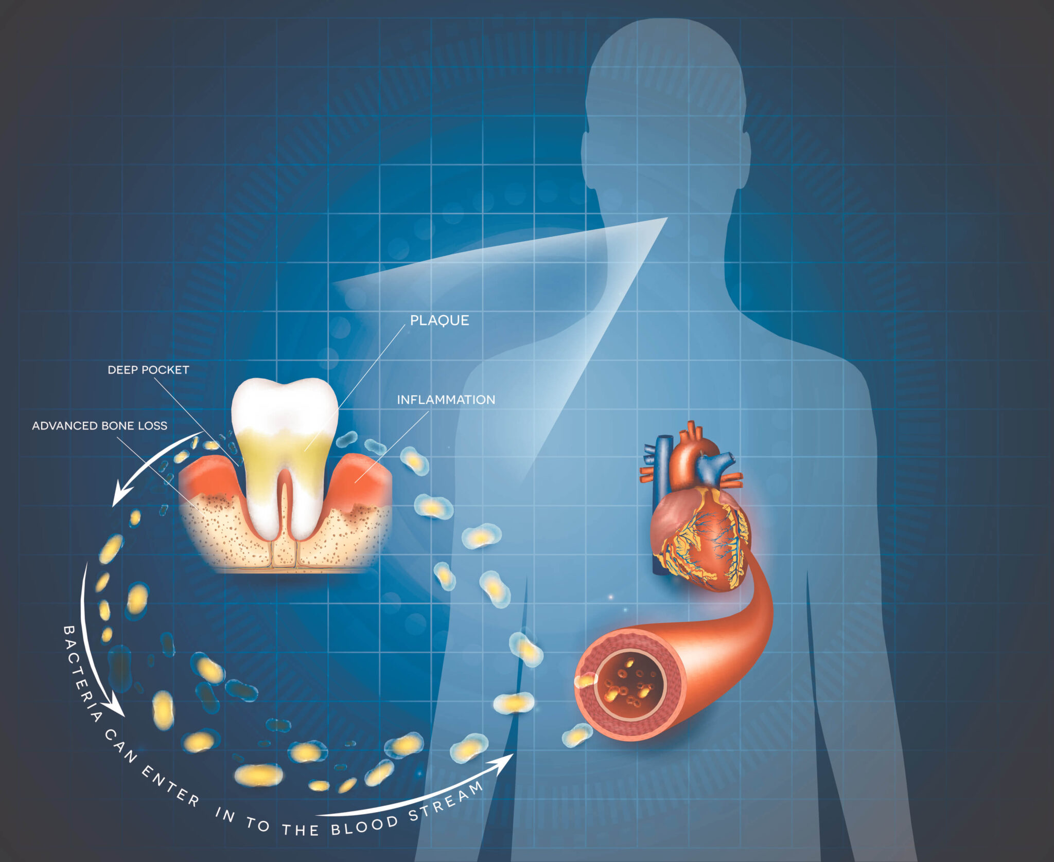 The Heart of the Matter Oral Disease and Cardiovascular Health
